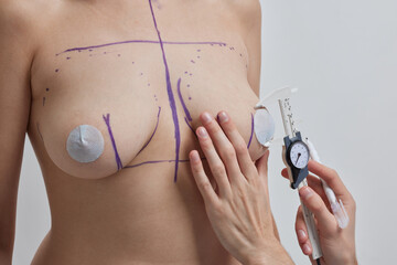 Breast Augmentation. Closeup Beautician Hands In Gloves Drawing Surgical Lines On Beautiful Woman...