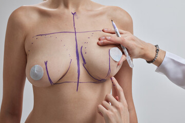 Doctor hand drawing lines on woman breast, breast implant surgery concept. - Powered by Adobe