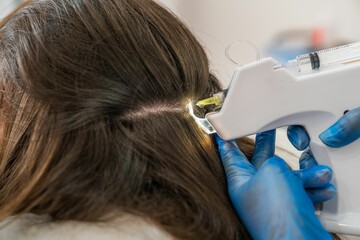 Fototapeta premium Application of capillary mesotherapy treatment to help with hair loss