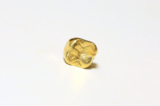 사용하다가 빠진 금니