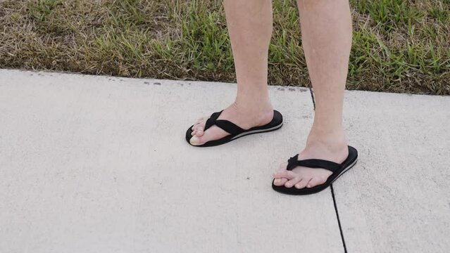 Feet with mallet toe, toes crossing over each other, wearing sandals
