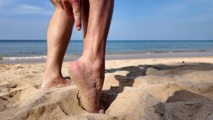 Close-up of an individual's sandy feet on a beach, beach fly bites, beach flea bites,  depicting a...