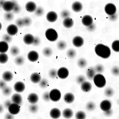 Dirty spots or microbes under a microscope