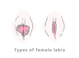 different types of female vulvae.  Women's vaginas of different colors and shapes.