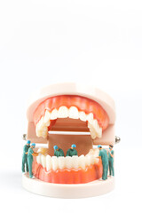 Miniature people , Dentist repairing human teeth with gums and enamel