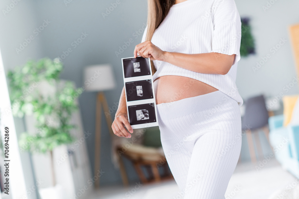 Poster cropped photo of happy mom showing x-ray scan icon picture waiting for her firstborn baby boy and gi