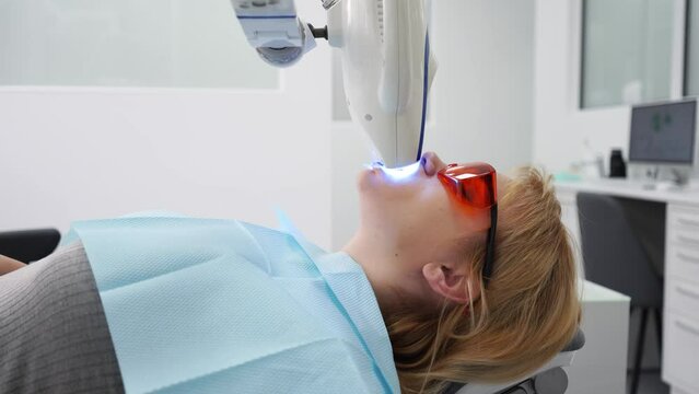 Close-up of female patient face at laser teeth whitening in the modern dental office. Blonde woman in protective red glasses bleaching teeth. Teeth whitening procedure with ultraviolet light UV lamp.