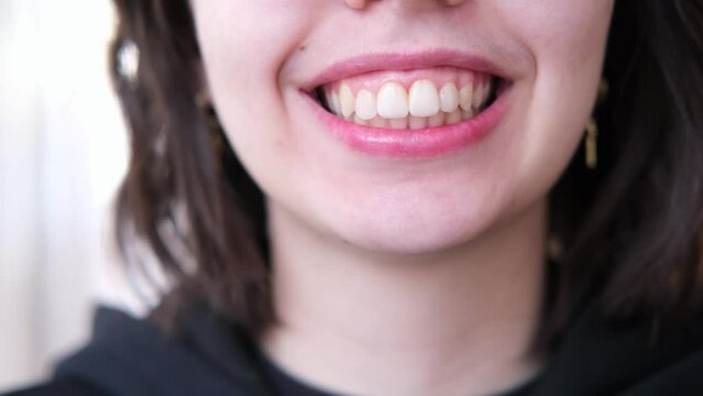 Cropped close-up view lower part face of young brunette woman, smiling, revealing demonstrating teeth, advertising professional dental clinic services, whitening procedure, veneers, short upper lip