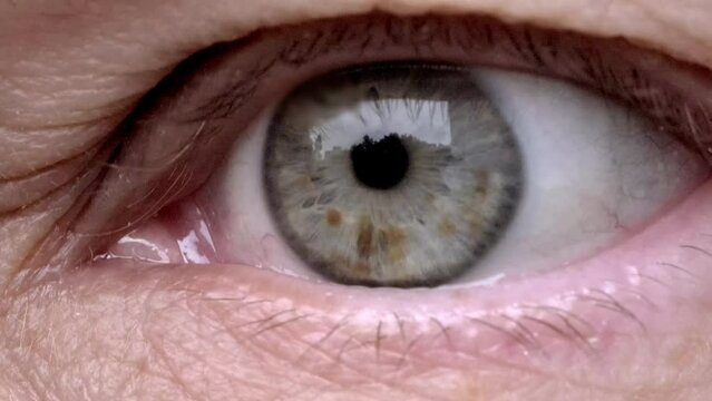 close up part face, human eye, spots on iris, lower, upper eyelid, deep wrinkles around eyes, age-related skin changes, cosmetic anti-aging procedures, vision check, hyperopia correction