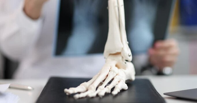 trauma surgeon evaluates x-rays of legs. Skeletal foot symptoms and treatment concept