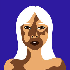 Elderly woman with vitiligo skin disease asian in minimalistic style