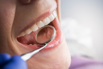 close up of an oral teeth exam at a dentist office