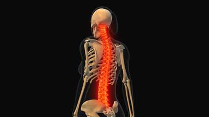 Medical animation of the spine bone pain