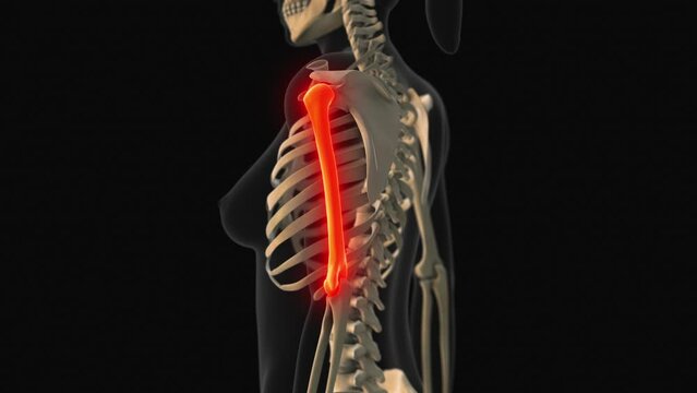 Medical animation of the humerus bone pain