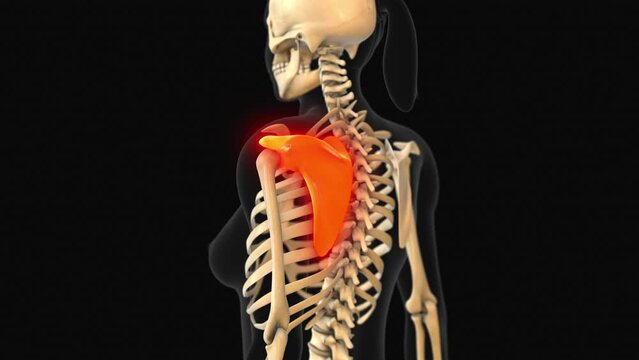 Medical animation of the scapula bone pain
