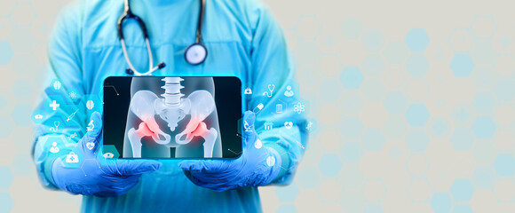 Pain in the cartilage joints, femoral head. Pelvis, degenerative hip disease. Inflammation due to arthritis and osteoarthritis. The pelvis x-ray is shown on the doctor's tablet.