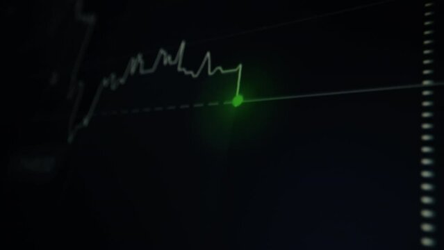 Stock market graph screen monitor with point up and down price or electrocardiogram ecg graph on the patient monitor