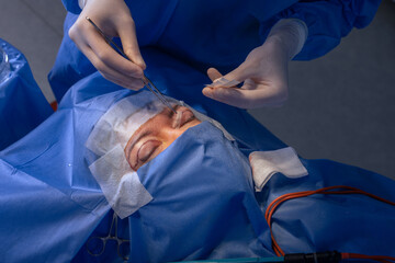 close-up eyes after eye surgery , blepharoplasty operation, plastic surgeon