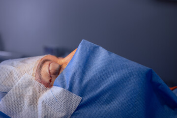 close-up eyes after eye surgery , blepharoplasty operation, plastic surgeon