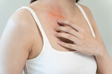 Sensitive skin allergic concept, Woman itching on her chest have a red rash from allergy symptom and from scratching.