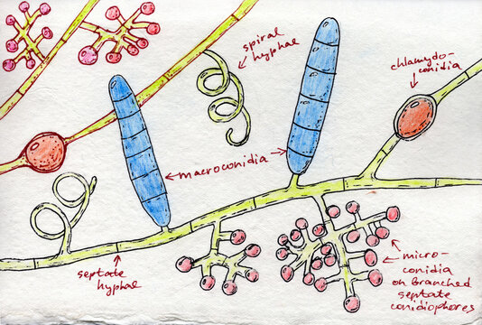 Hand-drawn illustration of Trichophyton mentagrophytes fungi on aged paper, reminiscent of medieval medical drawings, merging artistry with mycological depiction.