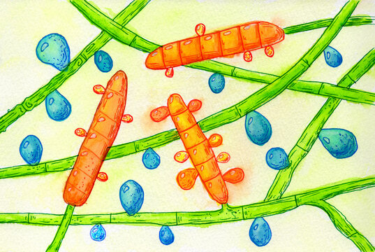 Fungus Trichophyton rubrum, hand-drawn watercolor illustration showing macroconidium, microconidia and septate hyphae. Infects skin and nails causing dermatophytosis.