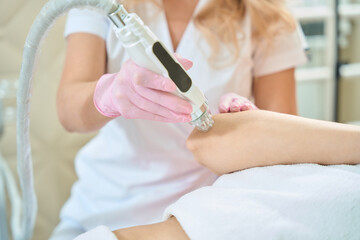 Partial of female cosmetologist doing microneedle rf lifting of woman elbow skin