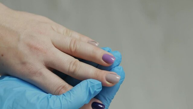 A doctor in a rubber glove examines a finger with a purulent abscess. Paronychia is an inflammation of the periarticular roller. Treatment of dermatological inflammations.