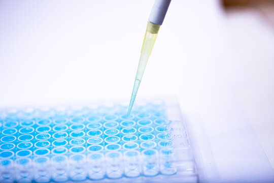 geneticist working with microplate for cells analysis in the genetic lab. Researcher working with samples of tissue culture in microplate in the bioengineering laboratory