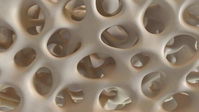 4k rendering of healthy bone structure change to osteoporosis(Close up)
