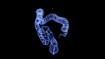 CT colonography , This imaging technique is often employed for colorectal cancer screening, providing detailed images of the colon's interior 3D rendering.
