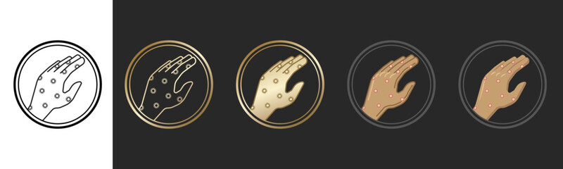 Ten plagues of Egypt - Boils