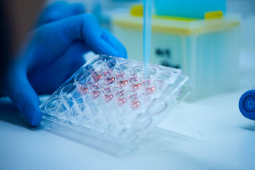 cell culture at the safety cabinet in cell culture laboratory, cancer and medicine research 