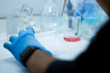 cell culture at the safety cabinet in cell culture laboratory, cancer and medicine research 