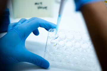 geneticist working with microplate for cells analysis in the genetic lab. Researcher working with samples of tissue culture in microplate in the bioengineering laboratory