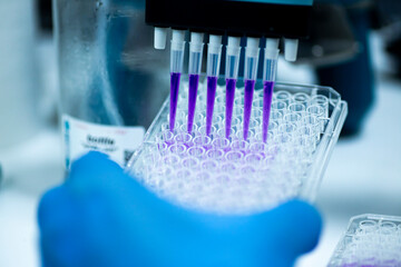 geneticist working with microplate for cells analysis in the genetic lab. Researcher working with samples of tissue culture in microplate in the bioengineering laboratory, medicine laboratory