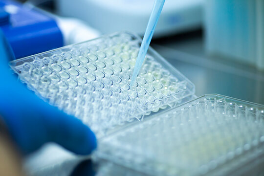 geneticist working with microplate for cells analysis in the genetic lab. Researcher working with samples of tissue culture in microplate in the bioengineering laboratory