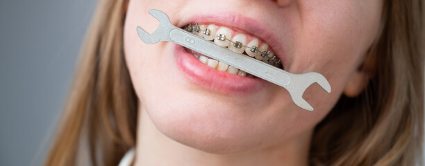 Close-up portrait of a woman with braces holding a wrench in her teeth. 