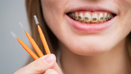 Close-up portrait of a woman with braces holding a floss to clean her teeth. 