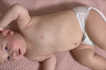 Roseola of the course of the disease in the baby, rash on the skin, the baby is capricious and...