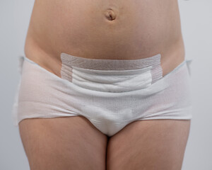 Close-up of a woman's belly after a caesarean section. 