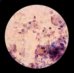 Trichomonas vaginalis is an anaerobic, flagellated protozoan parasite and the causative agent of trichomoniasis.