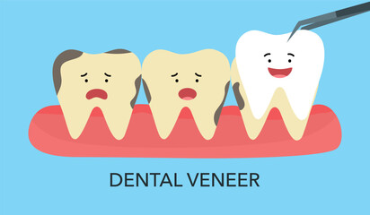 Smiling and upset teeth cartoon character on gum and veneer. Funny teeth dental restoration. Putting new veneer on discolored tooth.