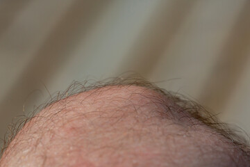 Macro shot of a human hair on the knee. - 709519427