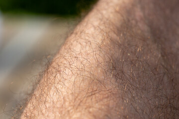 Macro shot of a human hair on the knee. - 709519455