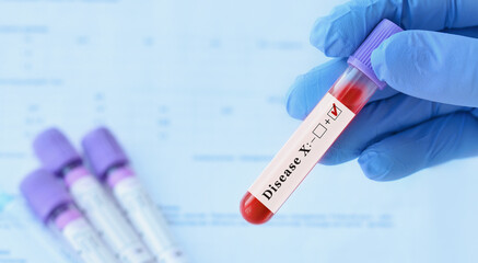 Doctor holding a test blood sample tube with positive Disease X test.The world is preparing for new...
