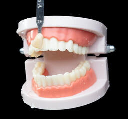 Artificial Tooth Plastic jaw check compare color with real crown. Dentist compare crown color Teeth of dental jaw model before operation. Black background isolated