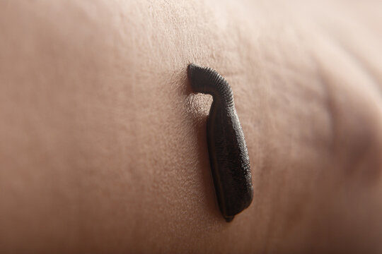 leech