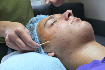 Obraz na płótnie Canvas Beautician applying medicinal acne cream to teenage boy