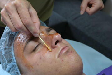 Beautician applying medicinal acne cream to teenage boy